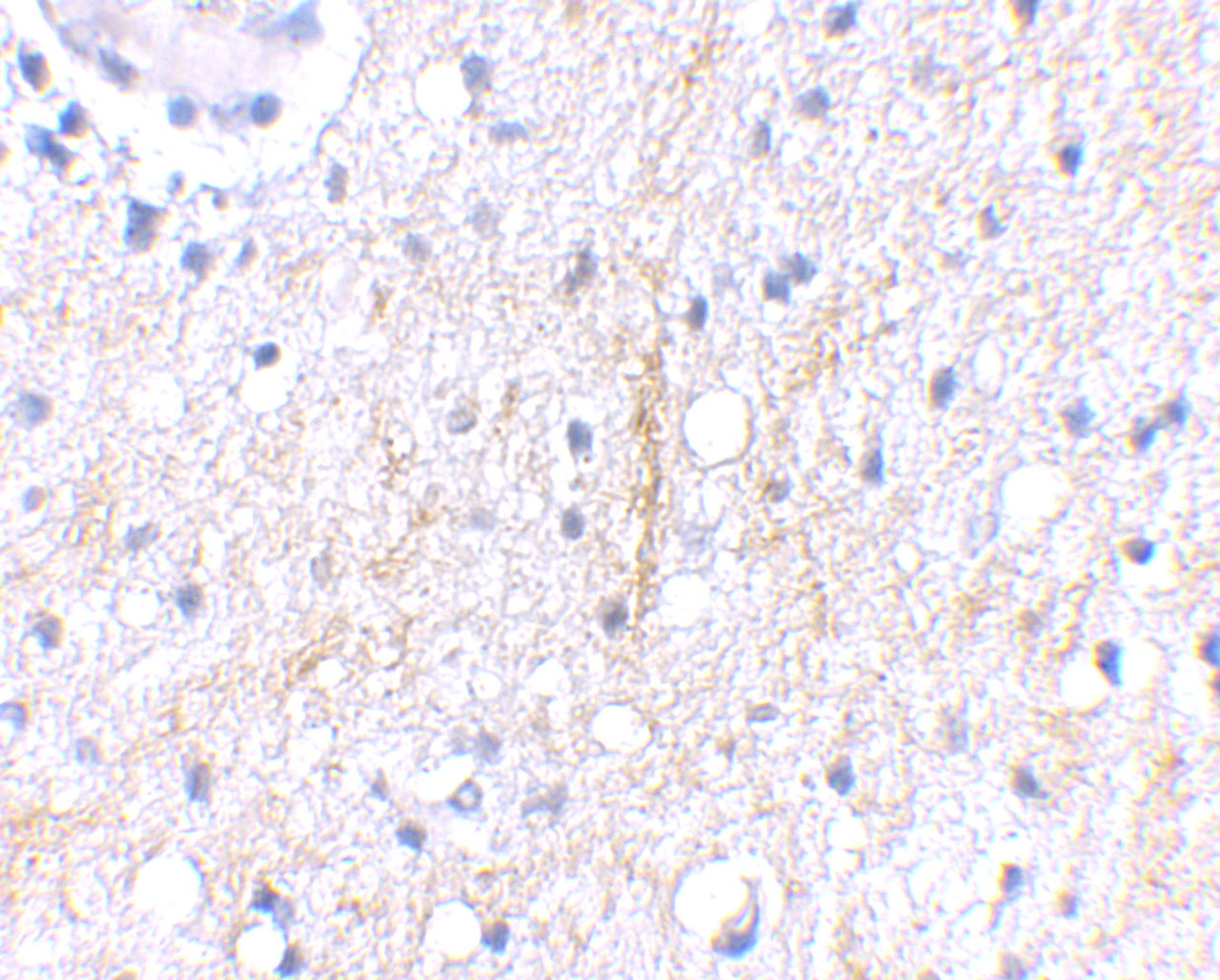 Immunohistochemical staining of human brain tissue using Plxdc2 antibody at 2.5 ug/mL.