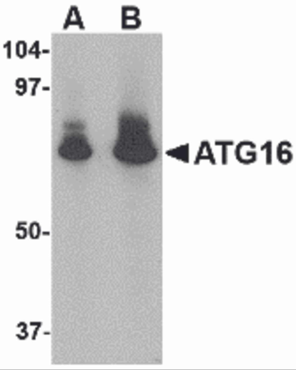 Western blot analysis of ATG16 in HeLa cell lysate with ATG16 antibody at (A) 1 and (B) 2 &#956;g/mL.