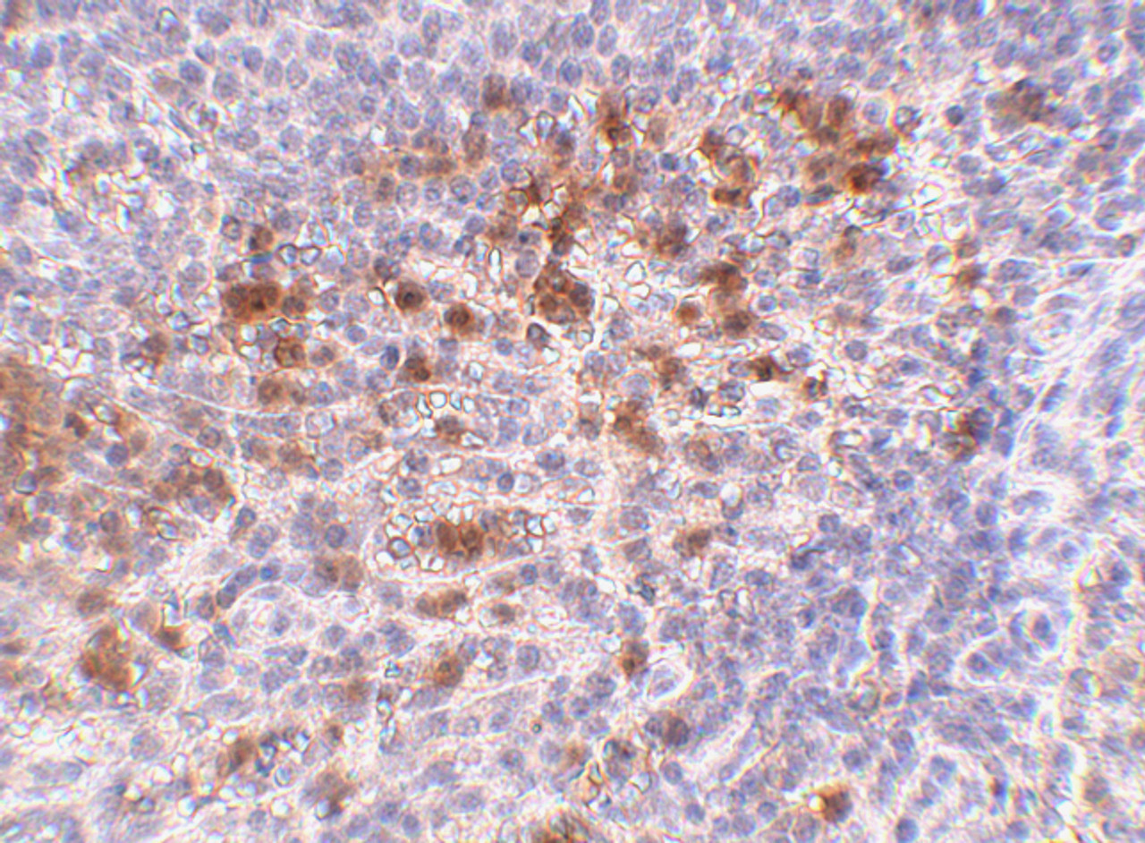 Immunohistochemistry of Catheli-cidin in human spleen tissue with Cathelicidin antibody at 5 ug/mL.