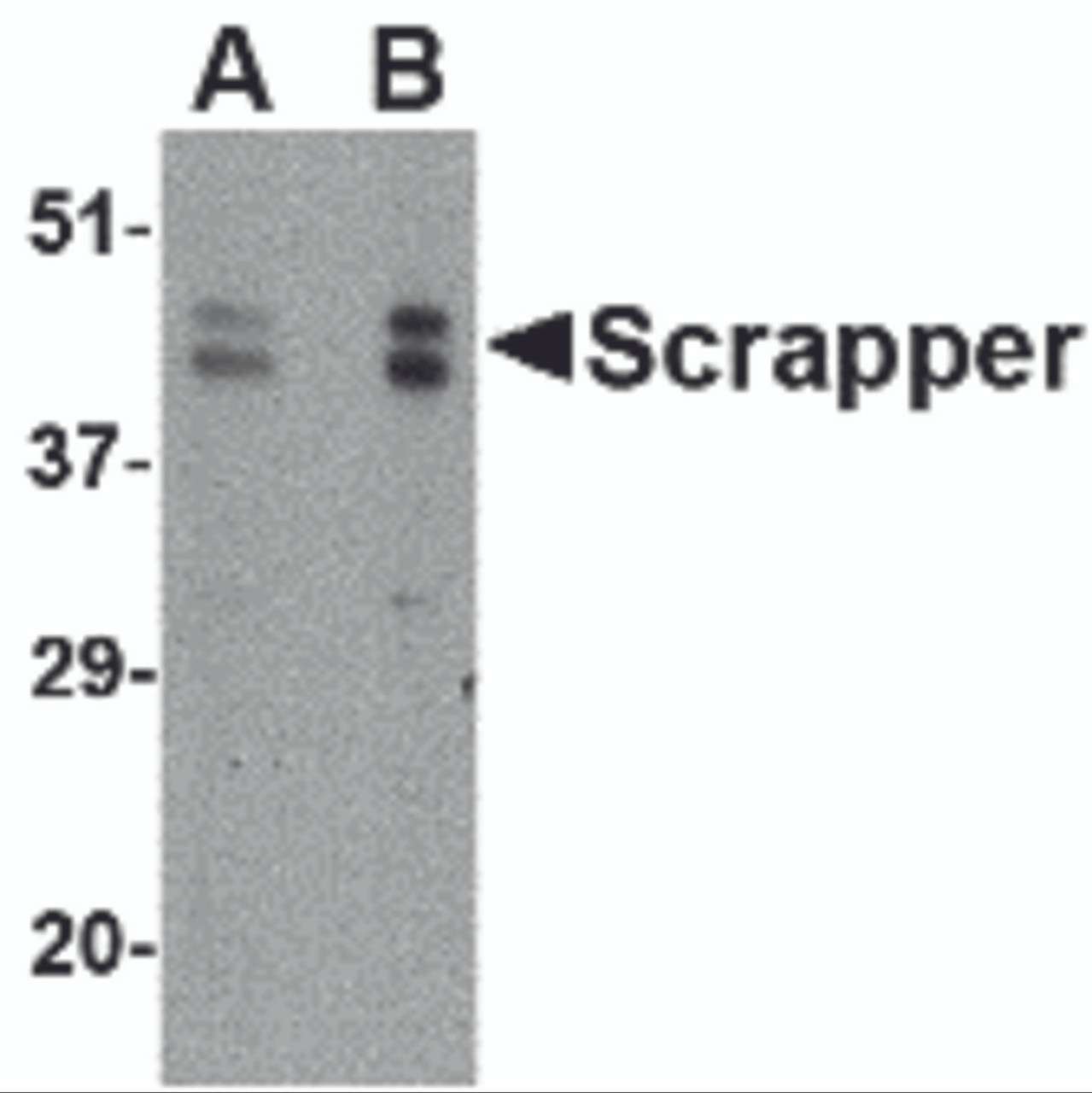 Western blot analysis of SCRAPPER in A20 cell lysate with SCRAPPER antibody at (A) 0.5 and (B) 1 &#956;g/mL.