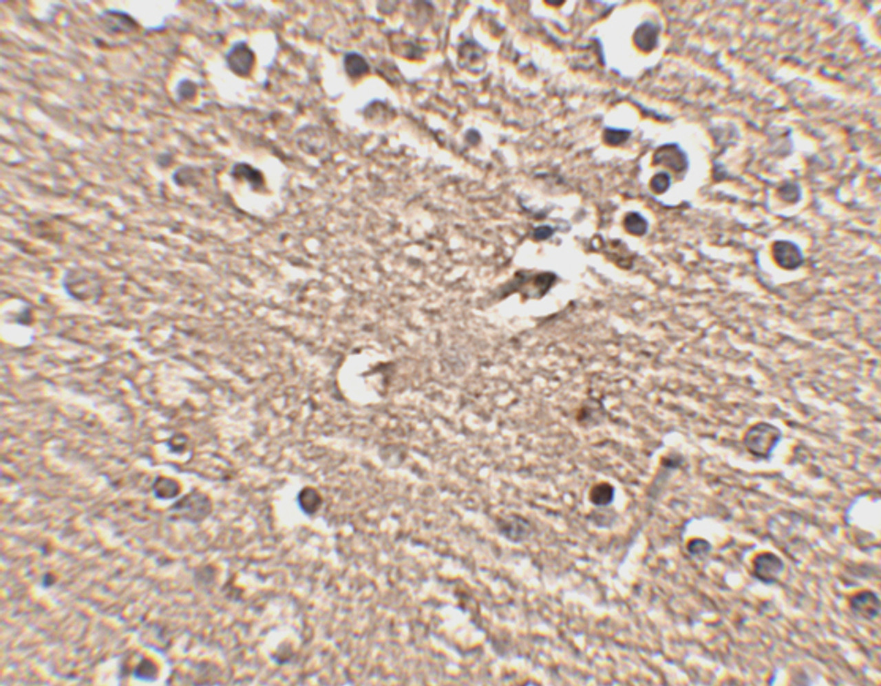 Immunohistochemistry of Slitrk1 in human brain tissue with Slitrk1 antibody at 2.5 ug/mL.