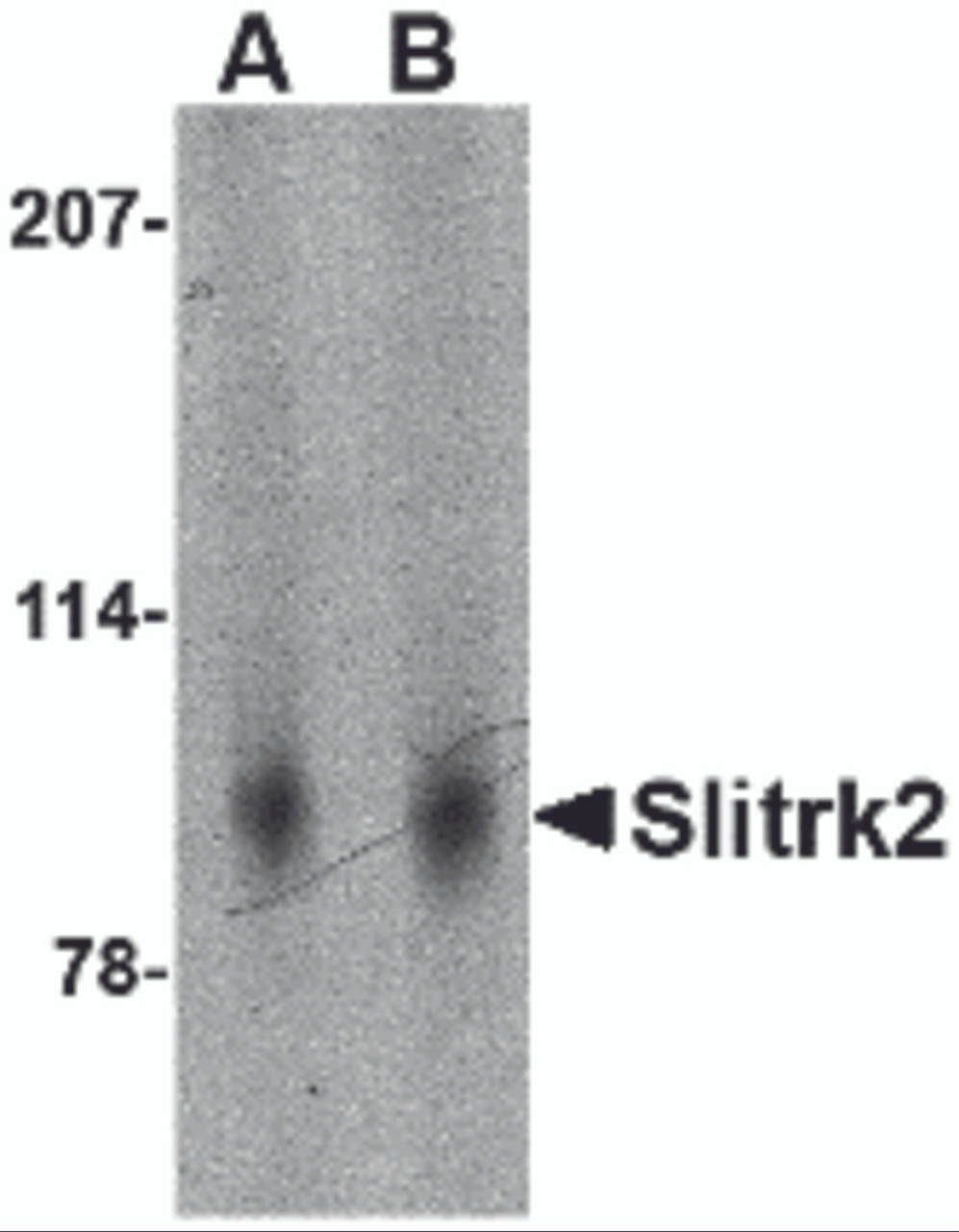 Western blot analysis of Slitrk2 in mouse brain tissue lysate with Slitrk2 antibody at (A) 1 and (B) 2 &#956;g/mL.