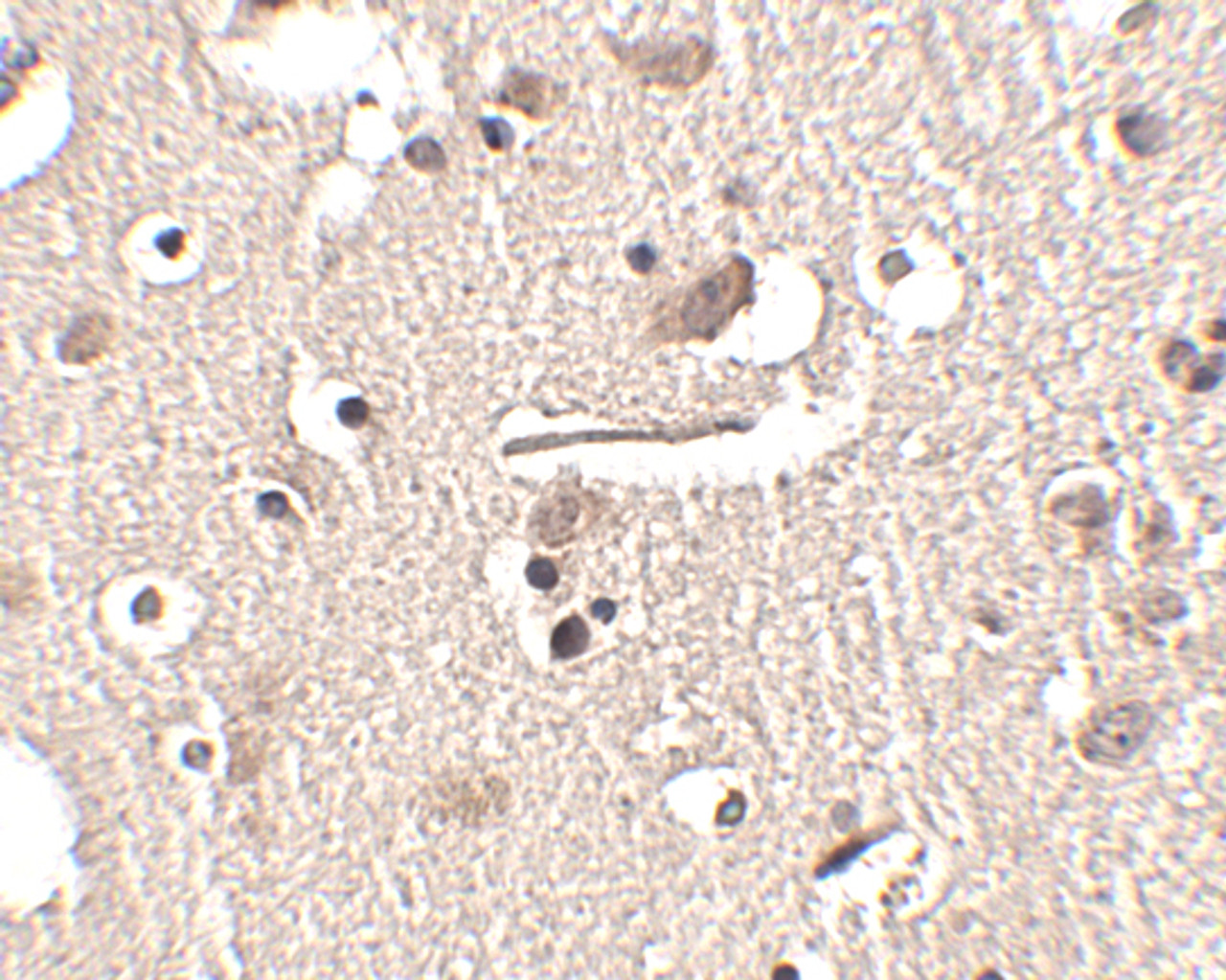 Immunohistochemistry of Slitrk2 in human brain tissue with Slitrk2 antibody at 2.5 ug/mL.