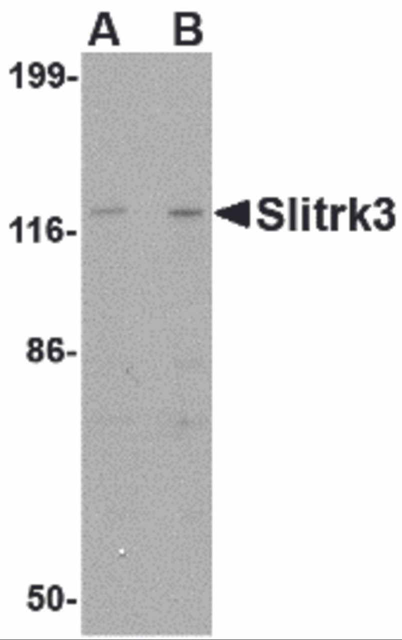 Western blot analysis of Slitrk3 in SK-N-SH cell lysate with Slitrk3 antibody at (A) 0.25 and (B) 0.5 &#956;g/mL.