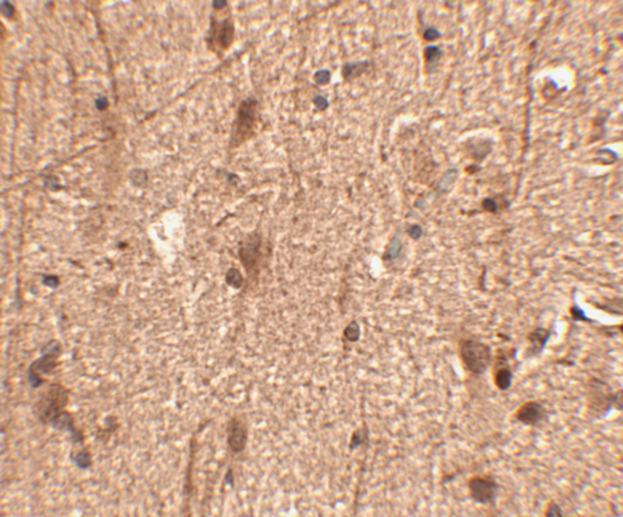 Immunohistochemistry of Slitrk3 in human brain tissue with Slitrk3 antibody at 2.5 ug/mL