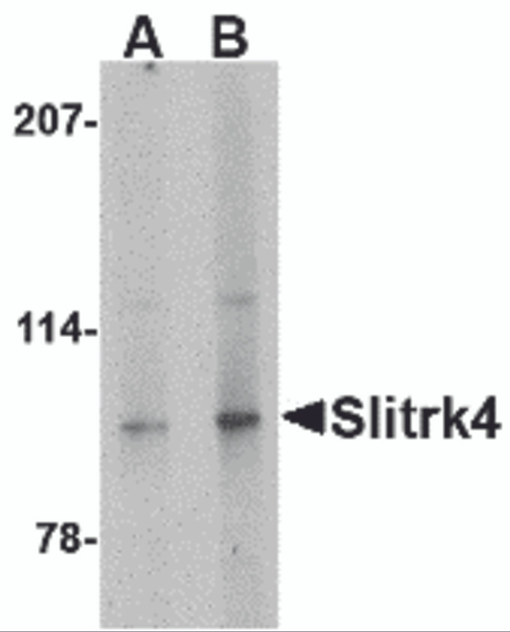 Western blot analysis of Slitrk4 in mouse brain tissue lysate with Slitrk4 antibody at (A) 0.5 and (B) 1 &#956;g/mL.