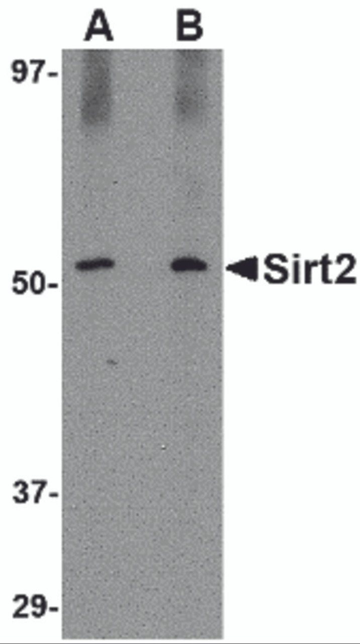 Western blot analysis of SIRT2 in Mouse brain lysate with SIRT2 antibody at (A) 1 and (B) 2 &#956;g/mL.