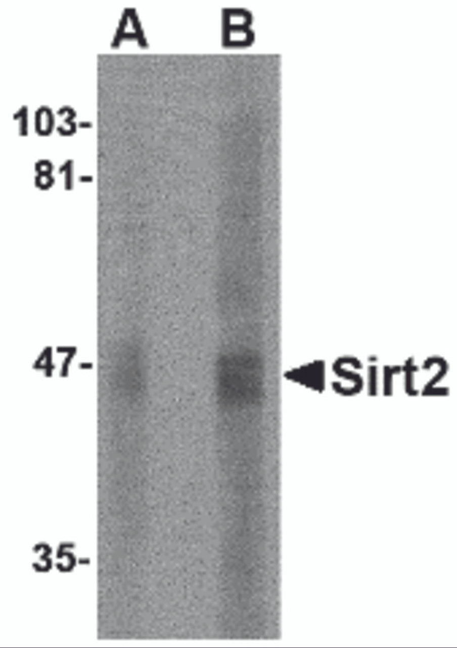 Western blot analysis of SIRT2 in human brain lysate with SIRT2 antibody at (A) 2.5 and (B) 5 &#956;g/mL.