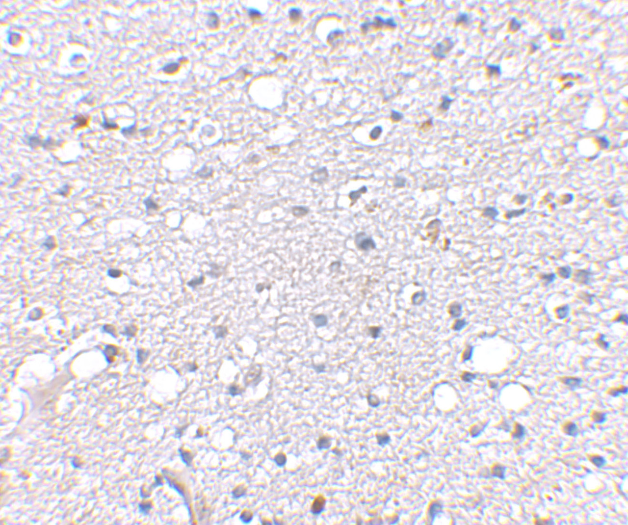 Immunohistochemical staining of human brain tissue using Sirt2 antibody at 2.5 ug/mL.