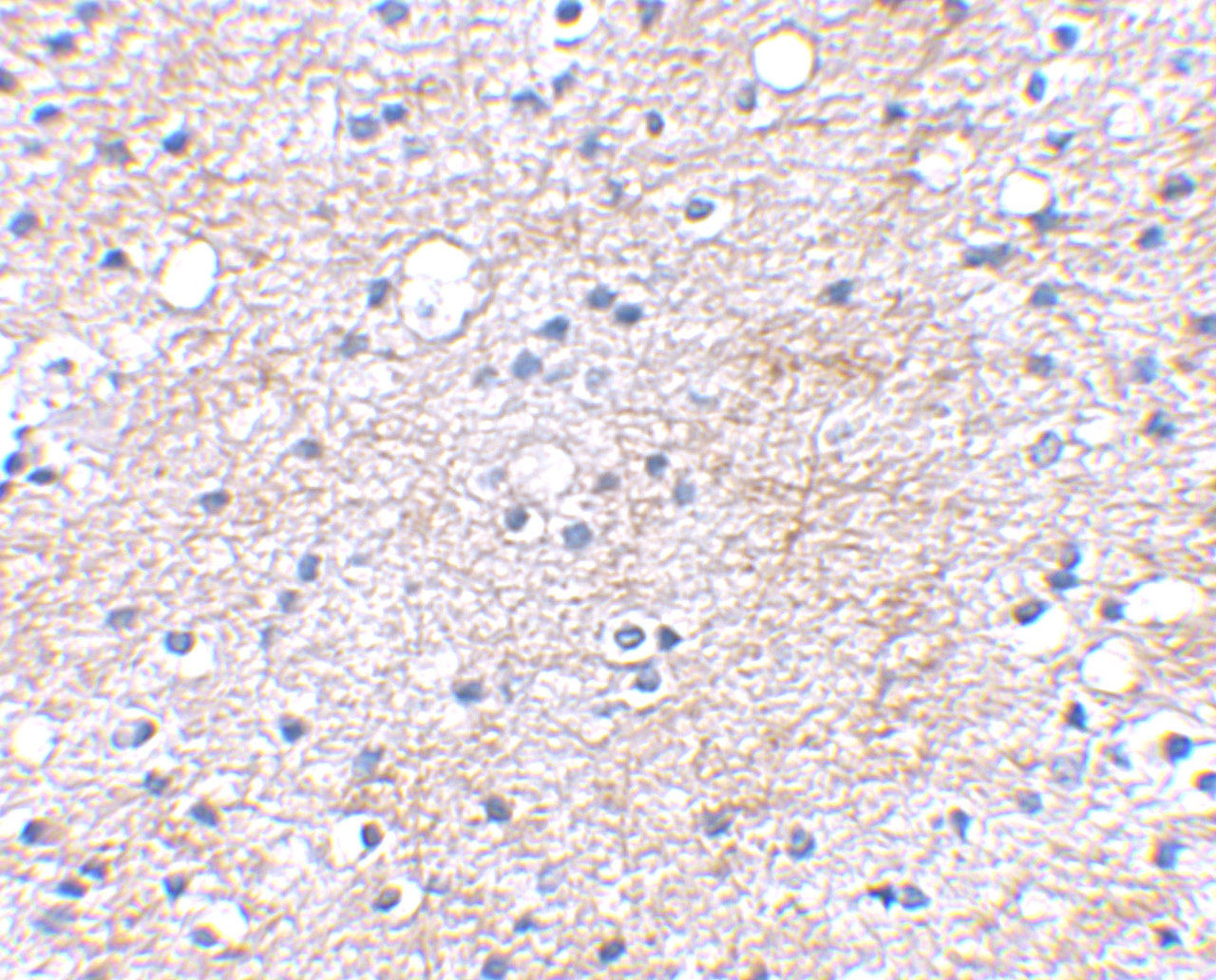Immunohistochemical staining of human brain tissue using LGI1 antibody at 2.5 ug/mL.