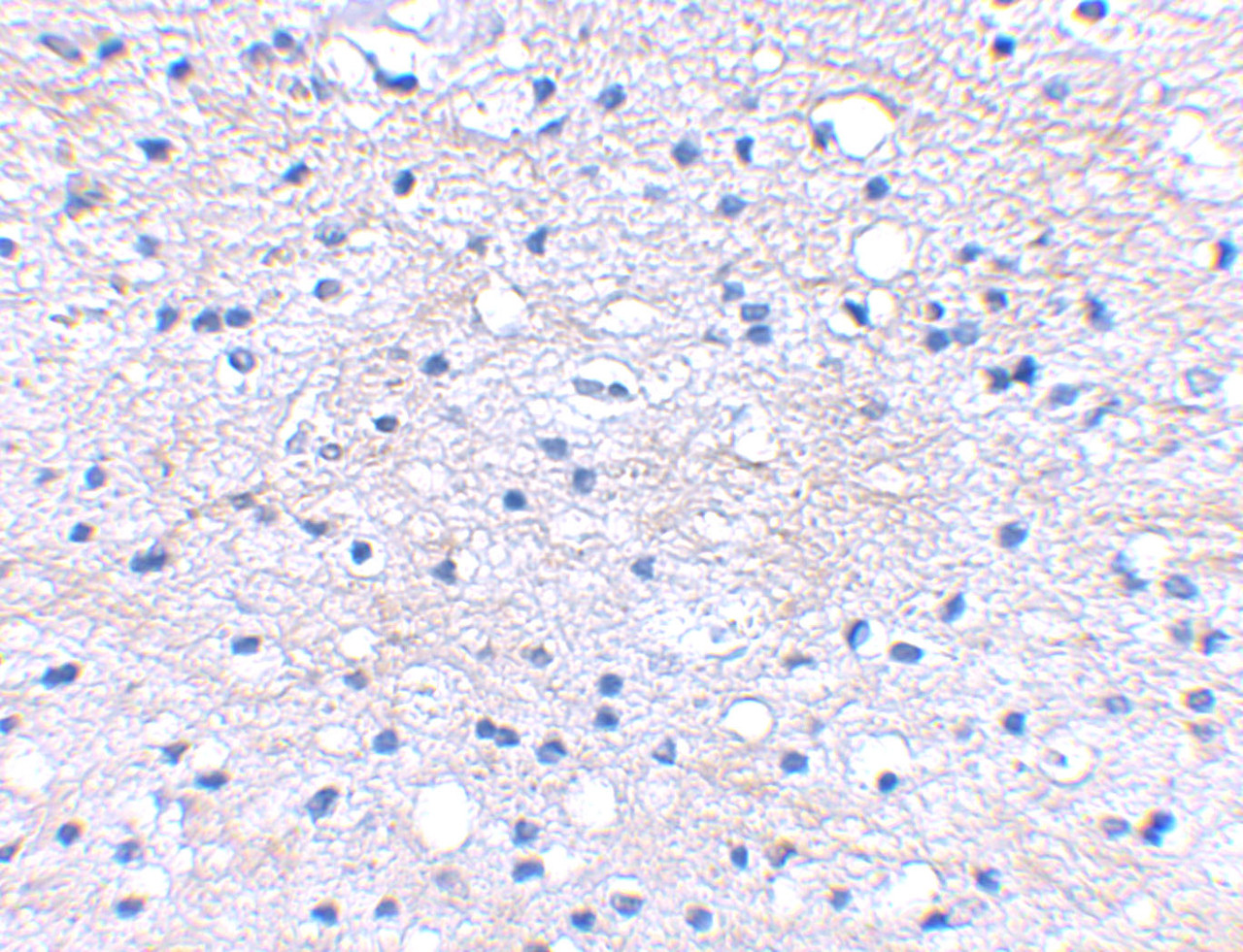 Immunohistochemical staining of human brain tissue using BRAL1 antibody at 2.5 ug/mL.