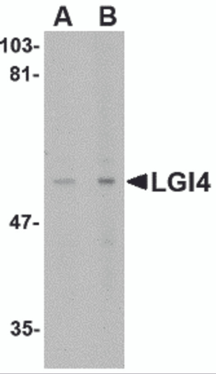 Western blot analysis of LGI4 in rat brain tissue lysate with LGI4 antibody at (A) 1 and (B) 2 &#956;g/mL.