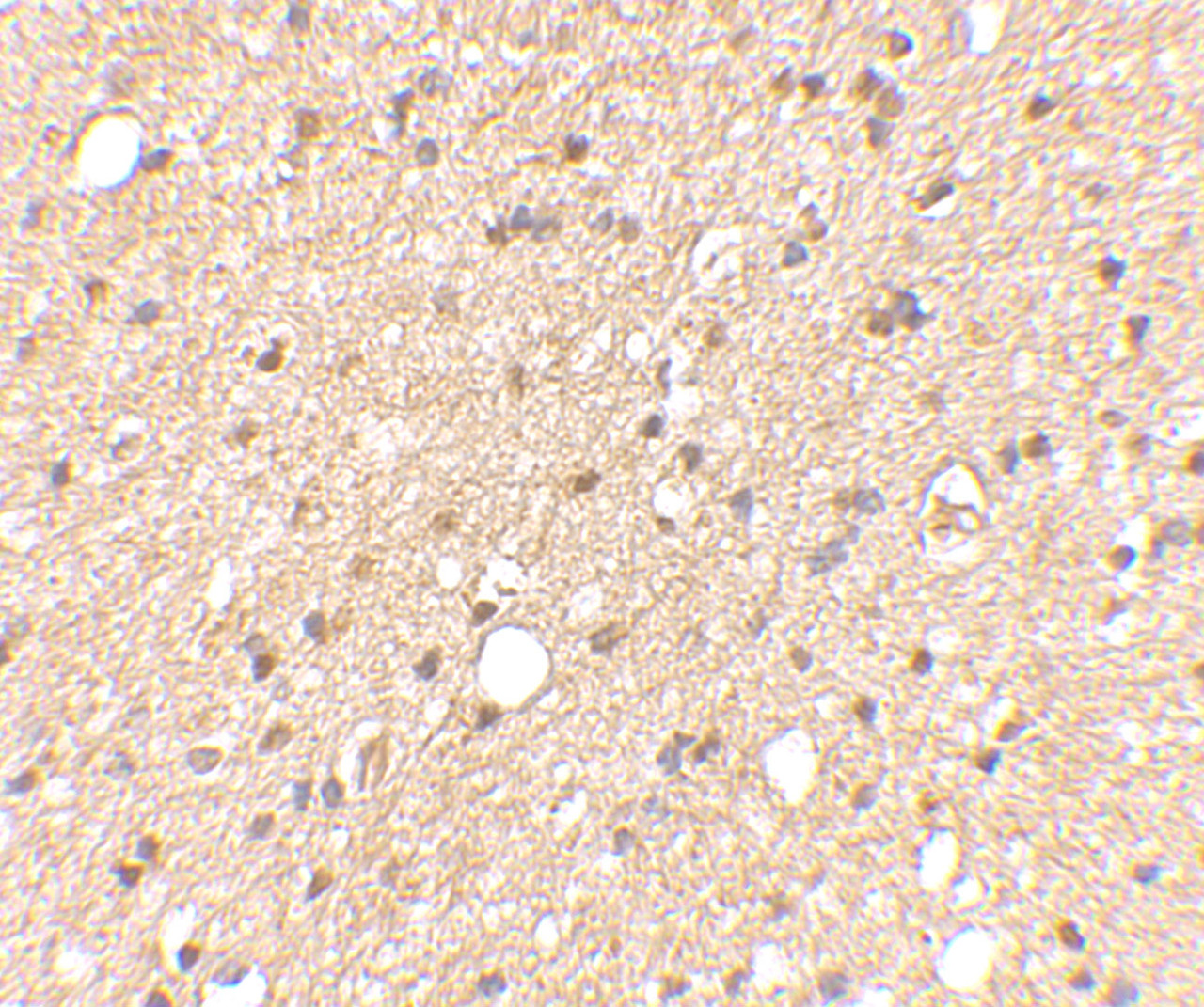 Immunohistochemical staining of human brain tissue using LGI2 antibody at 2.5 ug/mL.
