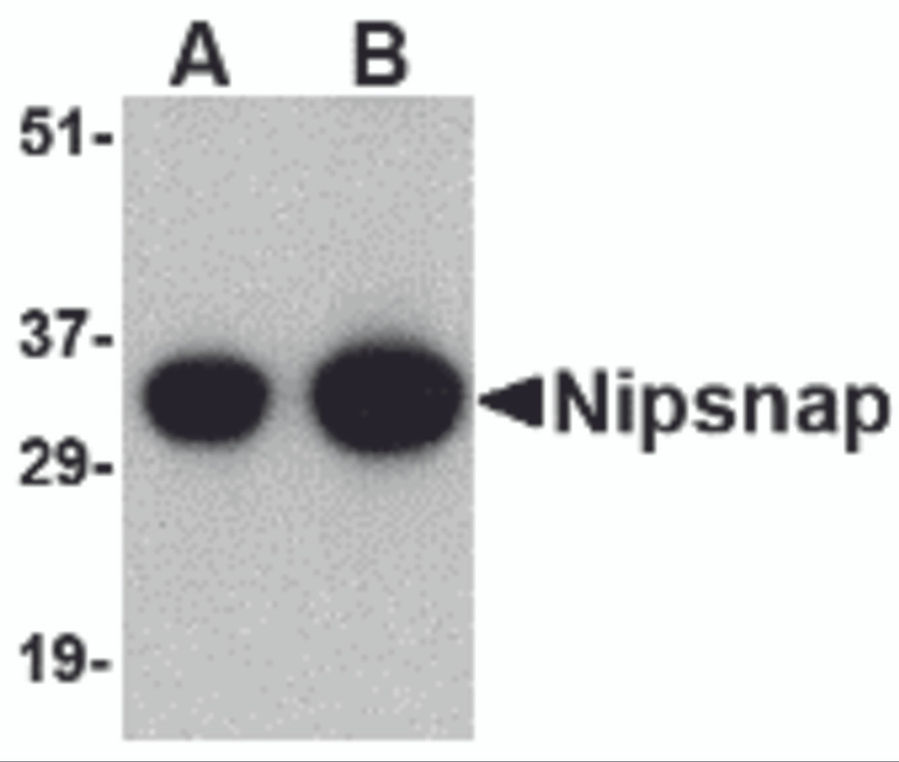 Western blot analysis of NIPSNAP in human brain tissue lysate with NIPSNAP antibody at (A) 0.5 and (B) 1 &#956;g/mL.