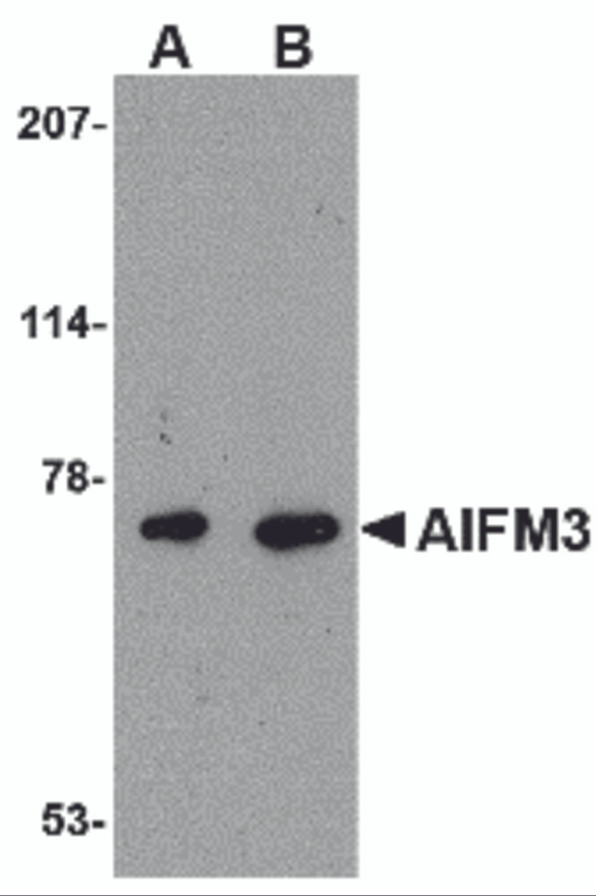 Western blot analysis of AIFM3 in human brain tissue lysate with AIFM3 antibody at (A) 1 and (B) 2 &#956;g/mL.