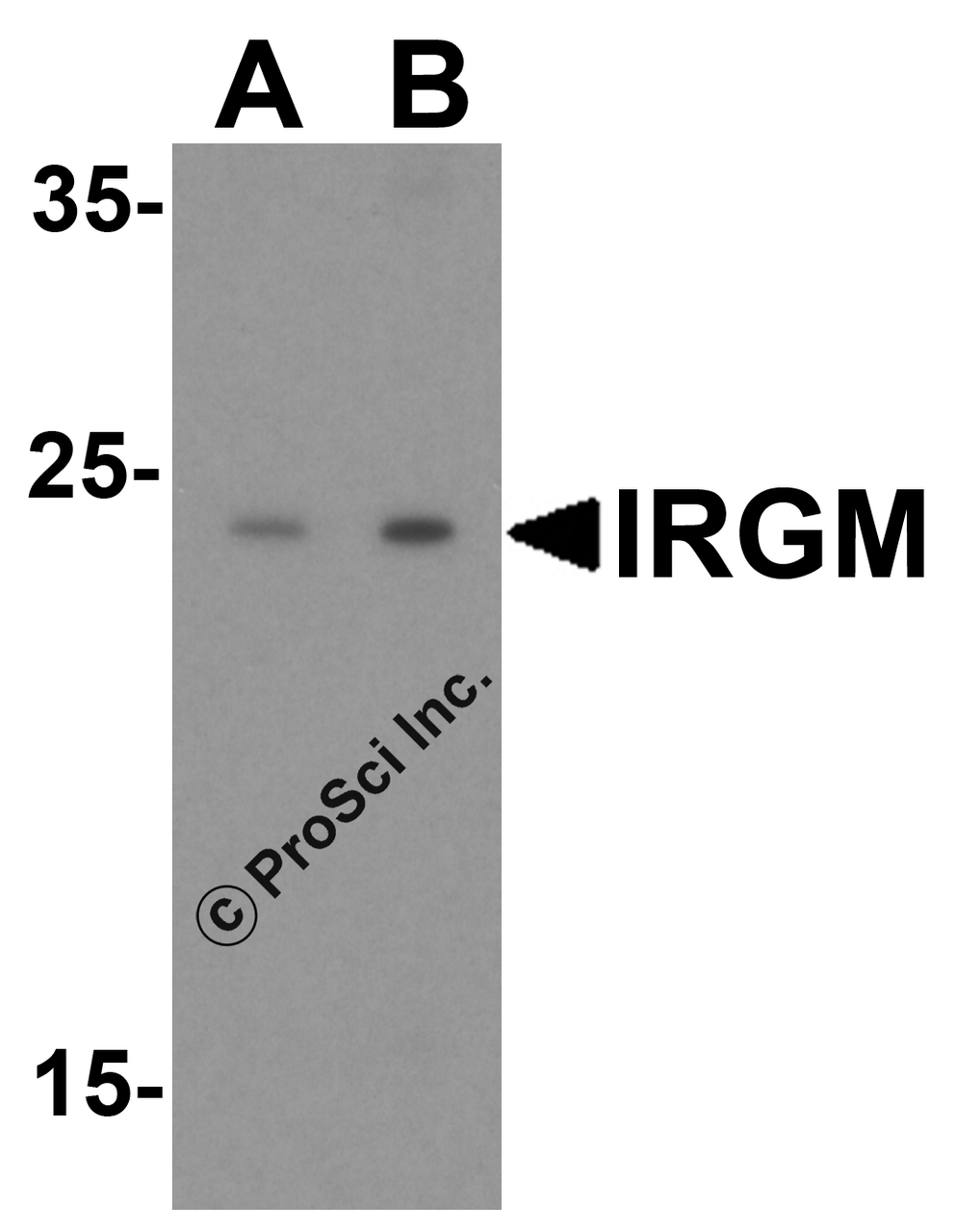 Western blot analysis of IRGM in human brain lysate with IRGM antibody at (A) 1 and (B) 2 &#956;g/mL.