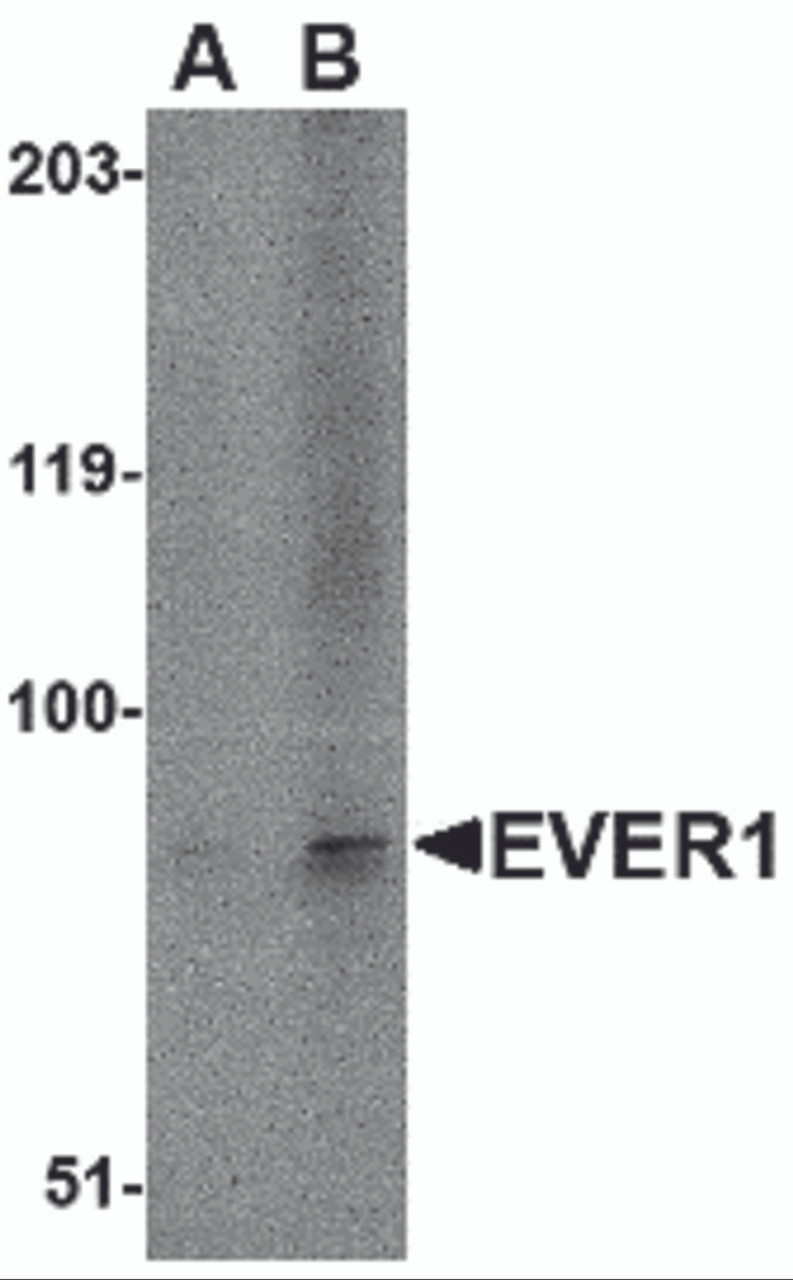 Western blot analysis of EVER1 in A-20 cell lysate with EVER1 antibody at (A) 1 and (B) 2 &#956;g/mL.