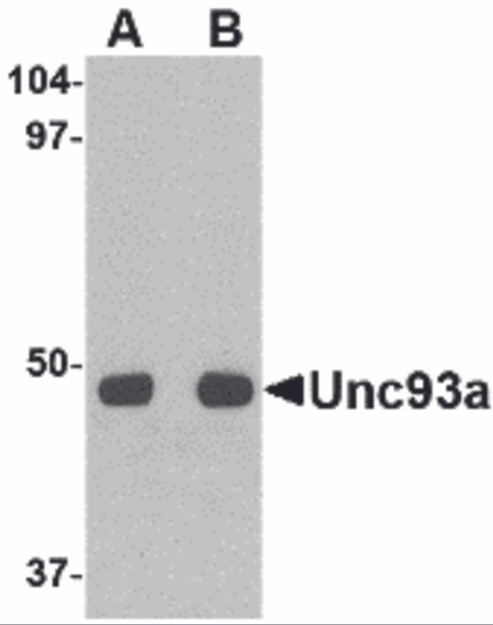 Western blot analysis of Unc93a in HeLa cell lysate with Unc93a antibody at (A) 0.5 and (B) 1 &#956;g/mL.