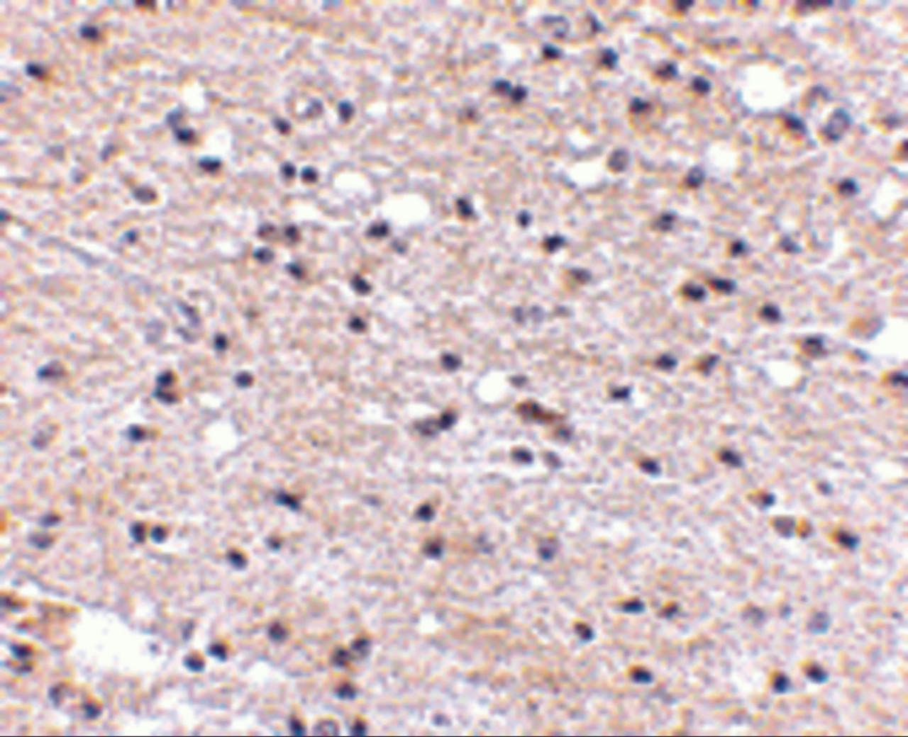 Immunohistochemistry of Ambra1 in human brain with Ambra1 antibody at 5 ug/mL.