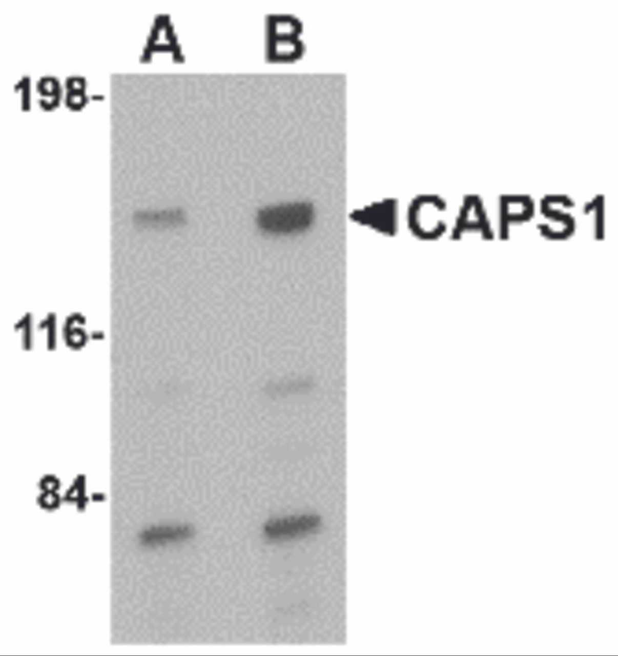 Western blot analysis of CAPS1 in rat brain tissue lysate with CAPS1 antibody at (A) 0.5 and (B) 1 &#956;g/mL.