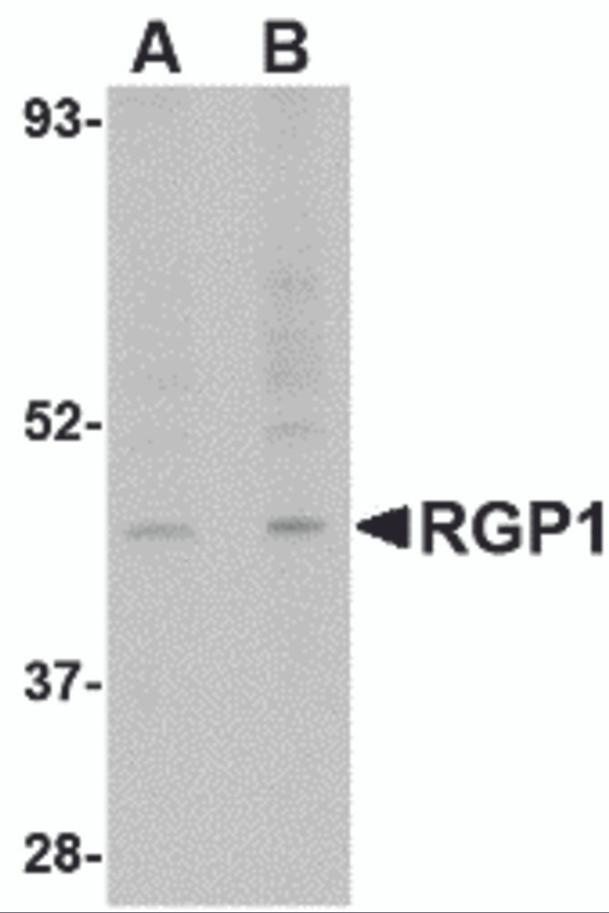 Western blot analysis of RGP1 in human heart tissue lysate with RGP1 antibody at (A) 1 and (B) 2 &#956;g/mL.