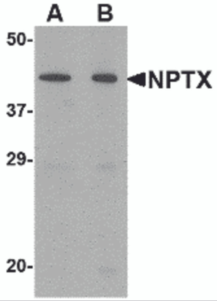 Figure 1 Western Blot Validation in Mouse Brain Tissue Lysate
Loading: 15 &#956;g of lysates per lane.
Antibodies: NPTX2 4573 (A: 0.5 &#956;g/mL, B: 1 &#956;g/mL) , 1h incubation at RT in 5% NFDM/TBST.
Secondary: Goat anti-rabbit IgG HRP conjugate at 1:10000 dilution.