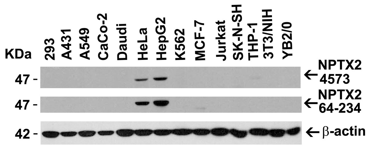 Figure 2 Independent Antibody Validation (IAV) via Protein Expression Profile in Cell Lines
Loading: 15 ug of lysates per lane.
Antibodies: NPTX2 4573 (2 ug/mL) , NPTX2 64-234 (4 ug/mL) , and beta-actin 3779 (1 ug/mL) , 1h incubation at RT in 5% NFDM/TBST.
Secondary: Goat anti-rabbit IgG HRP conjugate at 1:10000 dilution.