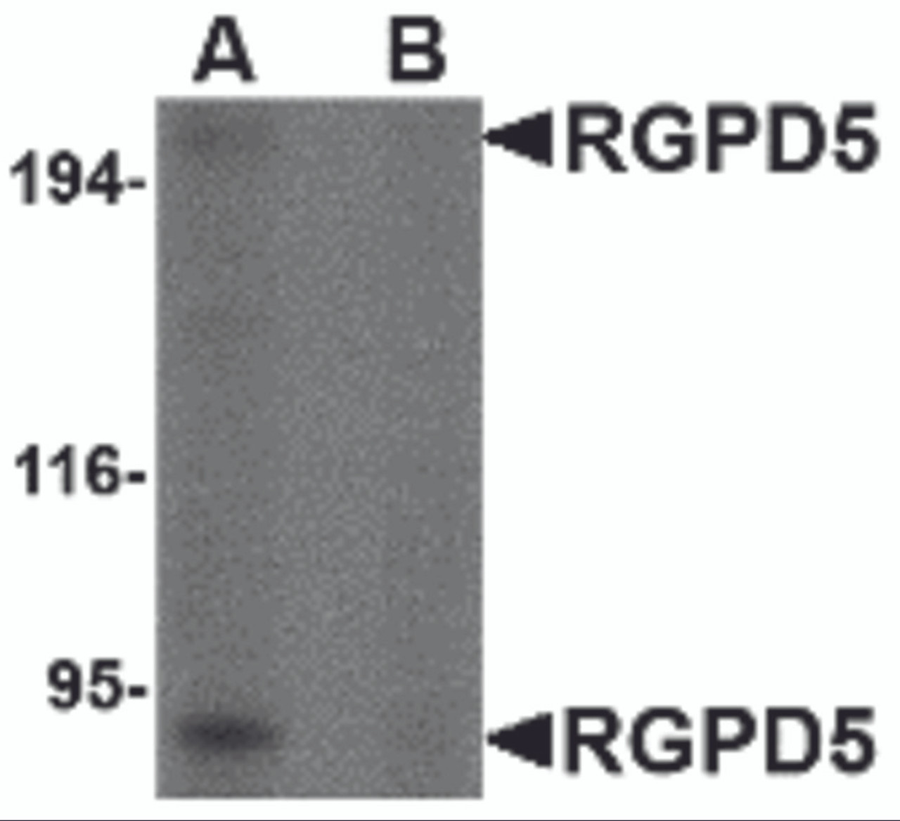 Western blot analysis of RGPD5 in human thymus tissue lysate with RGPD5 antibody at 1 &#956;g/mL in (A) the absence and (B) the presense of blocking peptide.
