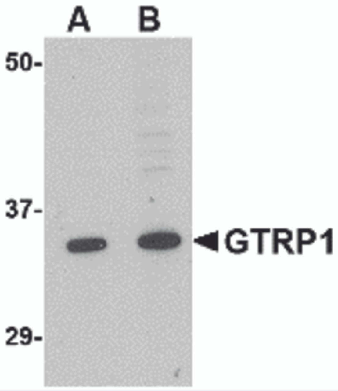 Western blot analysis of GRTP1 in K562 cell lysate with GRTP1 antibody at (A) 1 and (B) 2 &#956;g/mL.