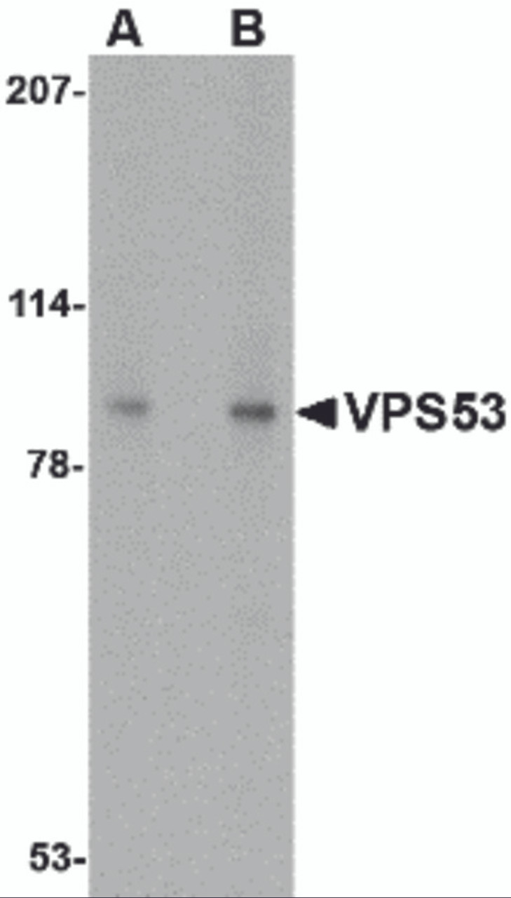 Western blot analysis of VPS53 in 293 cell lysate with VPS53 antibody at (A) 0.5 and (B) 1 &#956;g/mL.