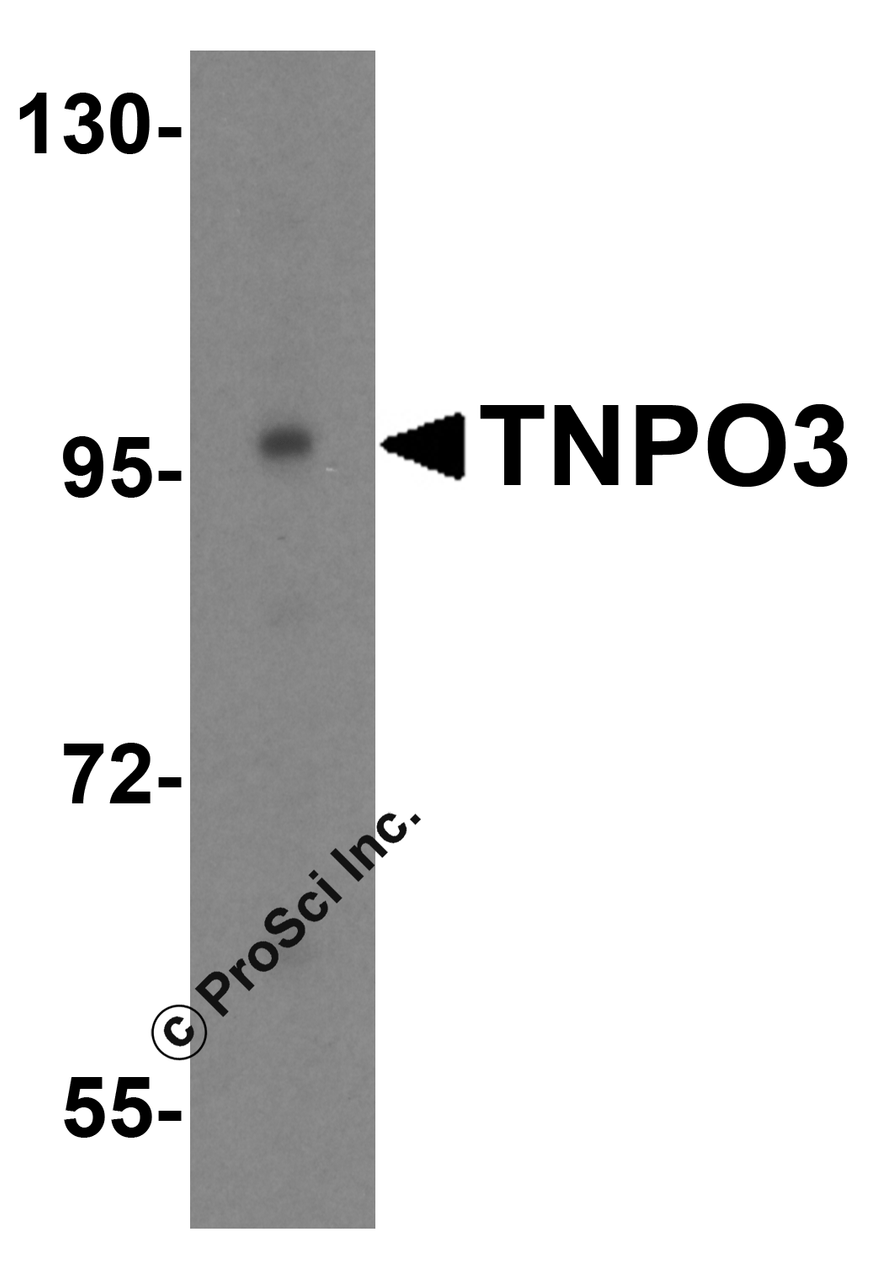 Western blot analysis of TNPO3 in HeLa cell lysate with TNPO3 antibody at 0.5 &#956;g/mL.