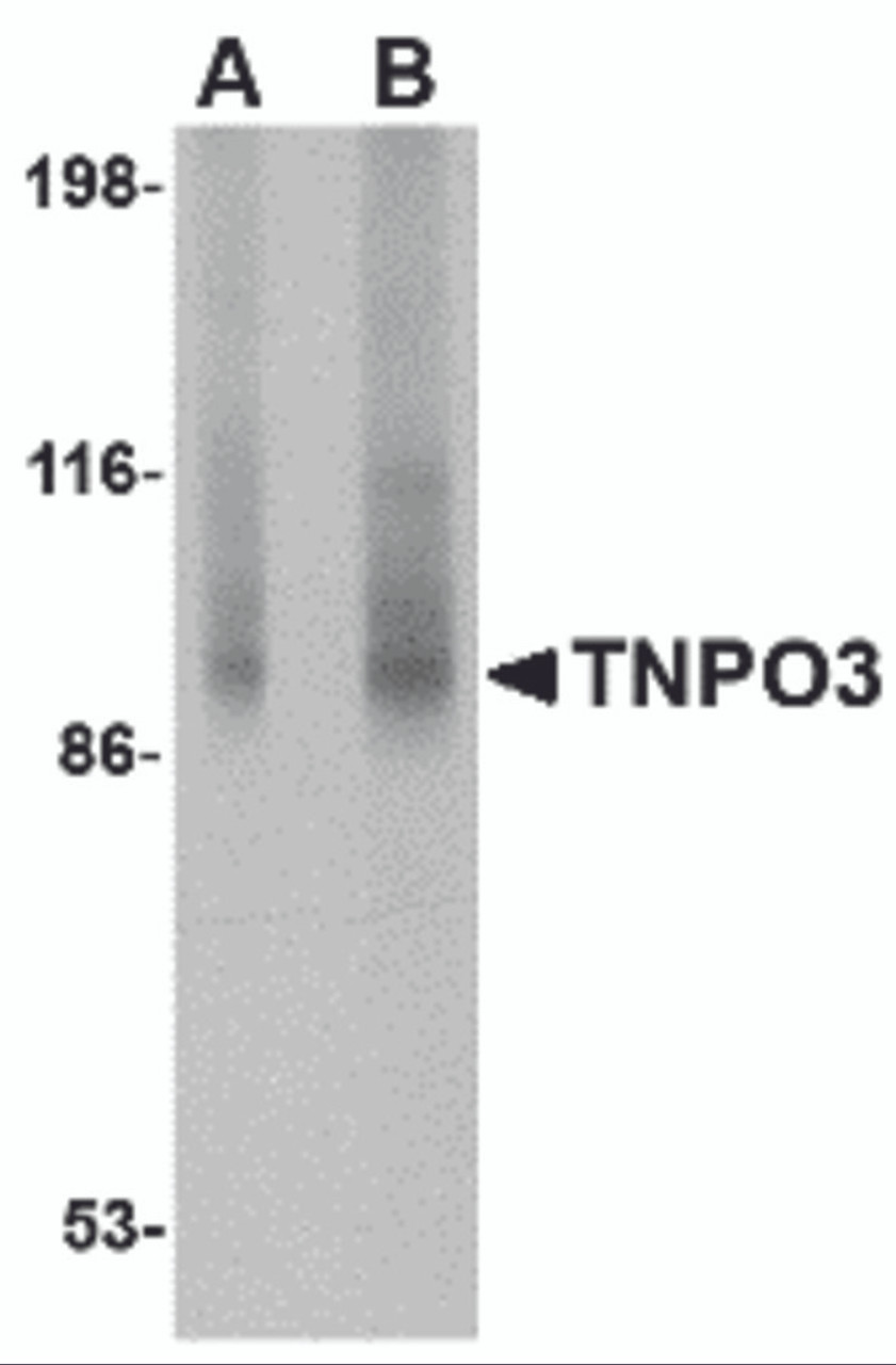 Western blot analysis of TNPO3 in rat liver tissue lysate with TNPO3 antibody at (A) 1 and (B) 2 &#956;g/mL.