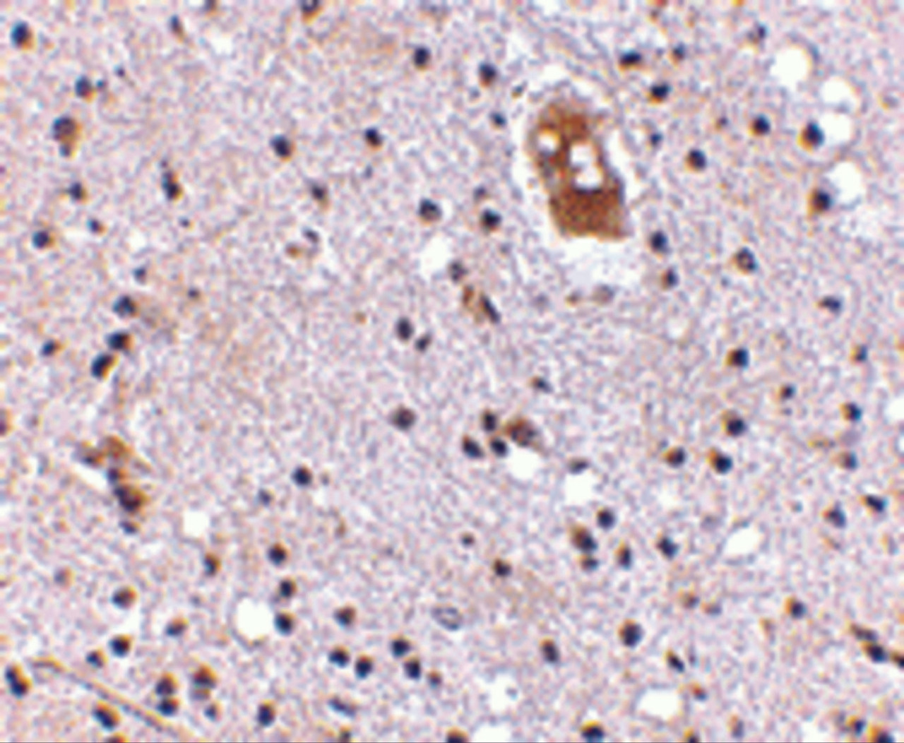 Immunohistochemistry of EVER2 in human brain with EVER2 antibody at 5 ug/mL.