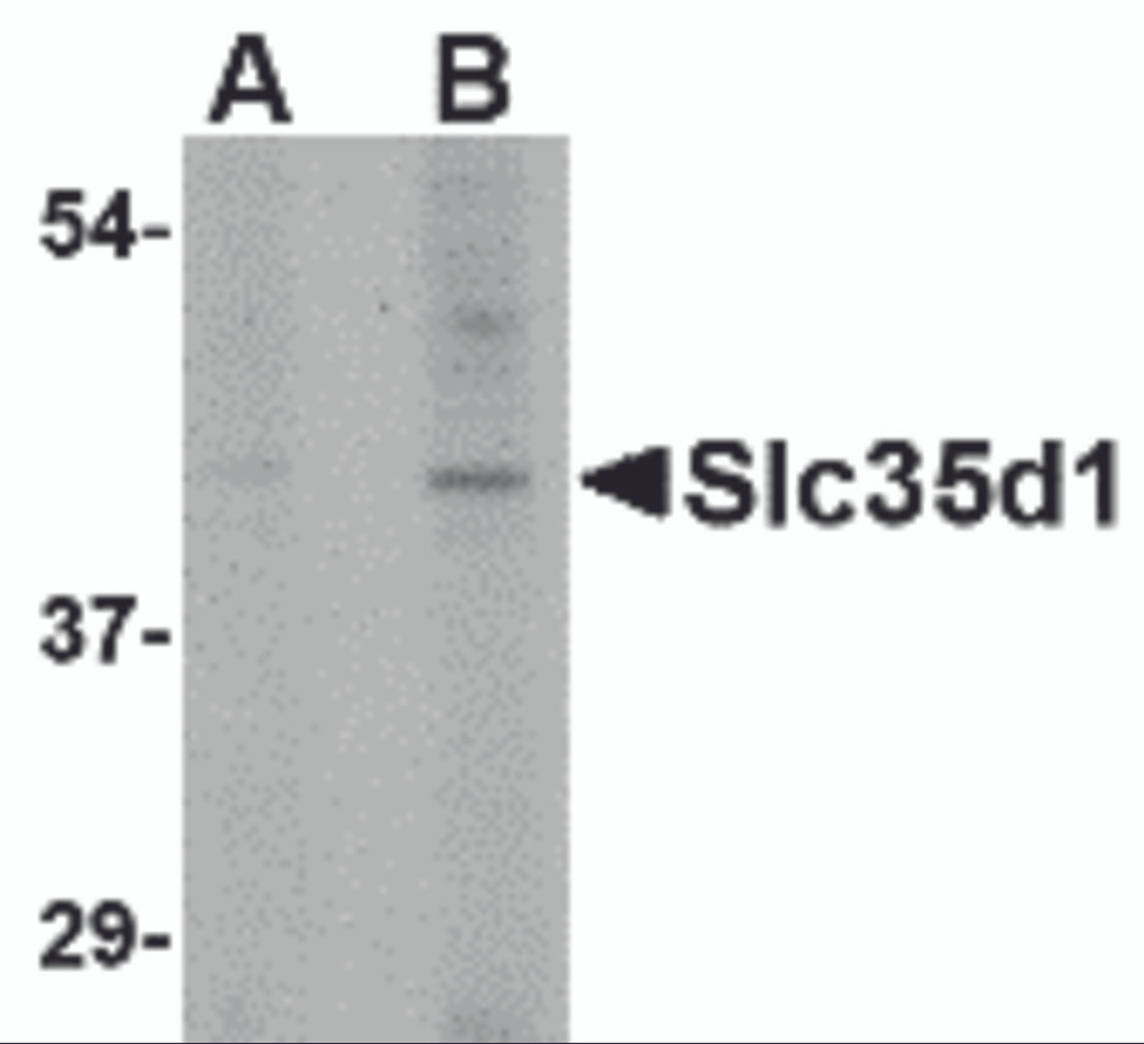Western blot analysis of Slc35D1 in Daudi lysate with Slc35D1 antibody at (A) 1 and (B) 2 &#956;g/mL.