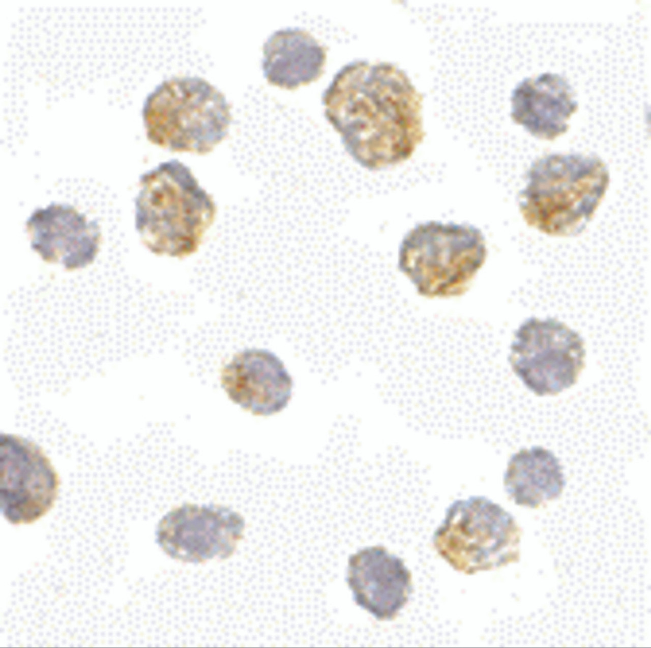 Immunocytochemistry of Slc35D1 in Daudi cells with Slc35D1 antibody at 5 ug/mL.