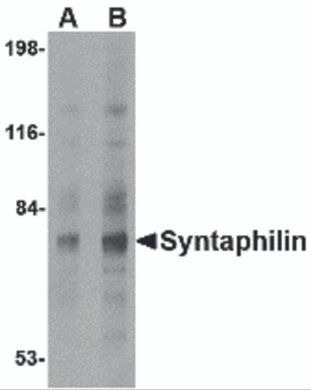 Western blot analysis of Syntaphilin in human brain tissue lysate with Syntaphilin antibody at (A) 2 and (B) 4 &#956;g/mL.