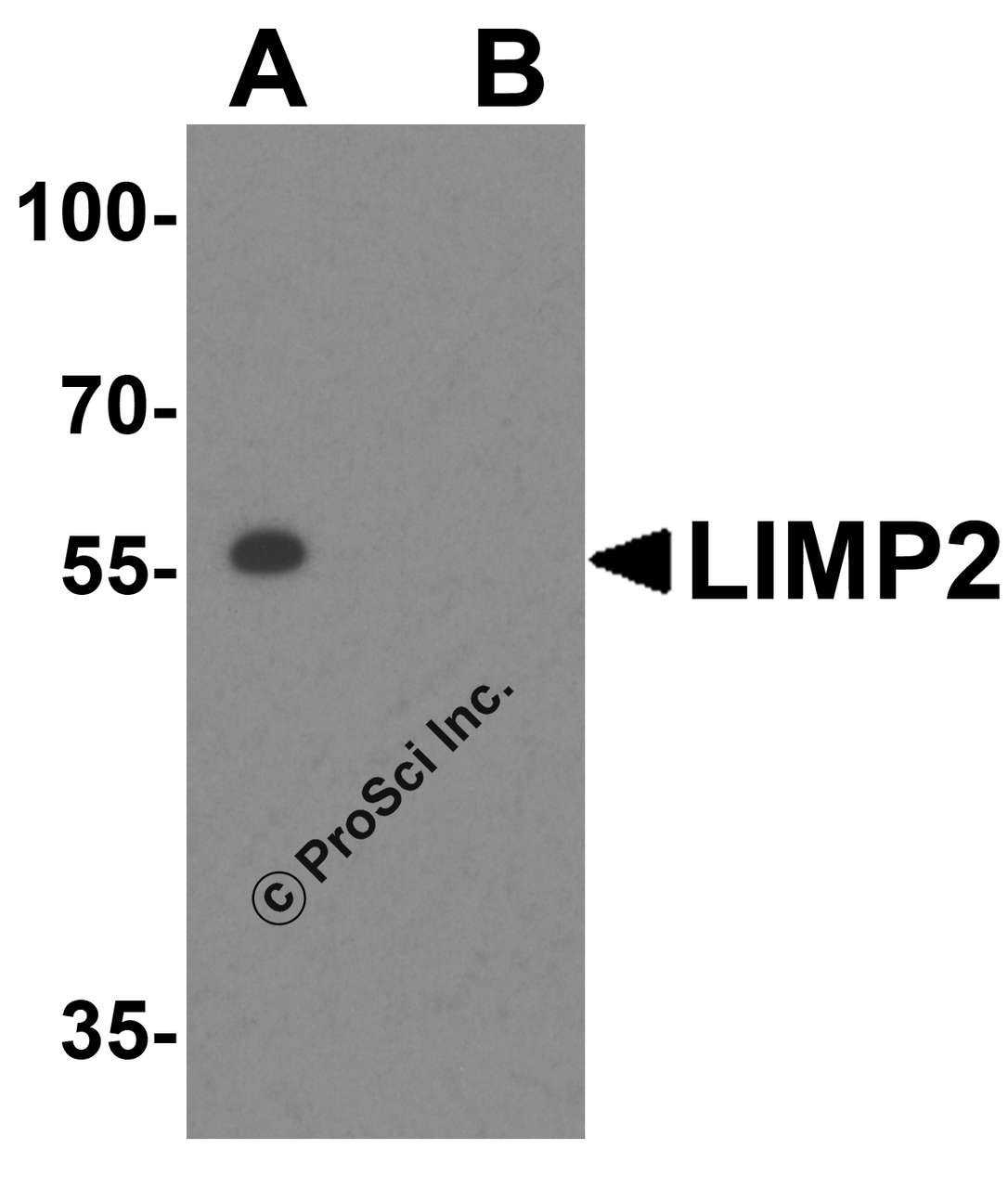 Western blot analysis of LIMP2 in mouse liver tissue lysate with LIMP2 antibody at 1 &#956;g/mL in (A) the absence and (B) presence of blocking peptide.