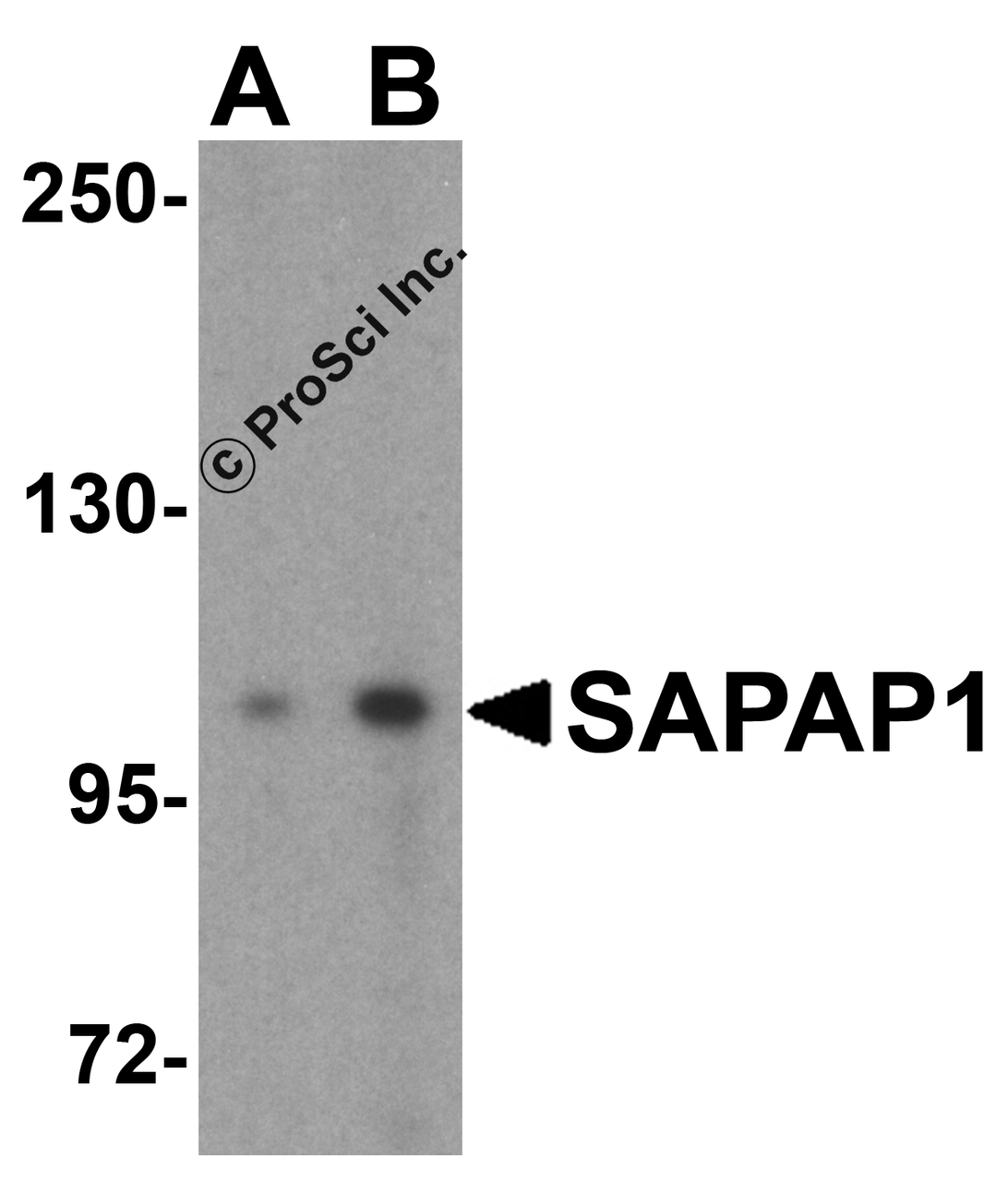 Western blot analysis of SAPAP1 in rat brain tissue lysate with SAPAP1 antibody at (A) 0.5 and (B) 1 &#956;g/mL.