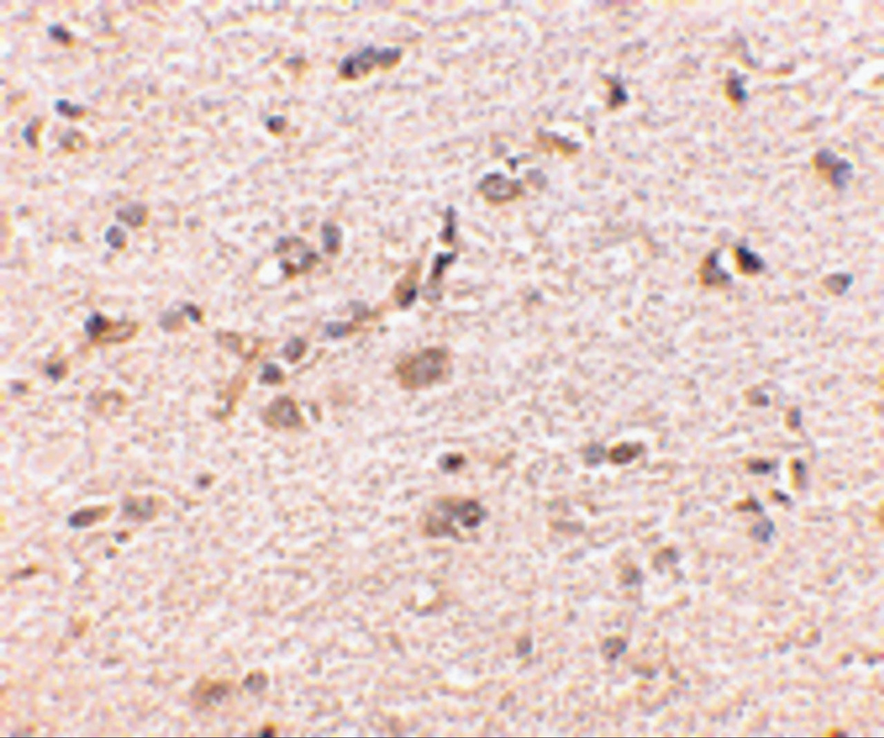 Immunohistochemistry of SAPAP1 in human brain with SAPAP1 antibody at 5 ug/mL.