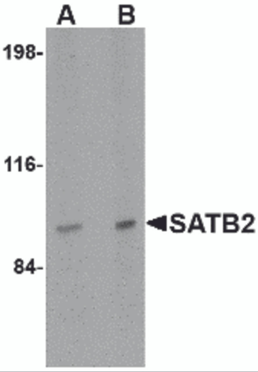 Western blot analysis of SATB2 in mouse brain tissue lysate with SATB2 antibody at (A) 2 and (B) 4 &#956;g/mL.