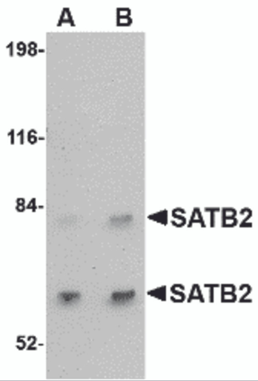 Western blot analysis of SATB2 in A20 cell lysate with SATB2 antibody at (A) 2 and (B) 4 &#956;g/mL.