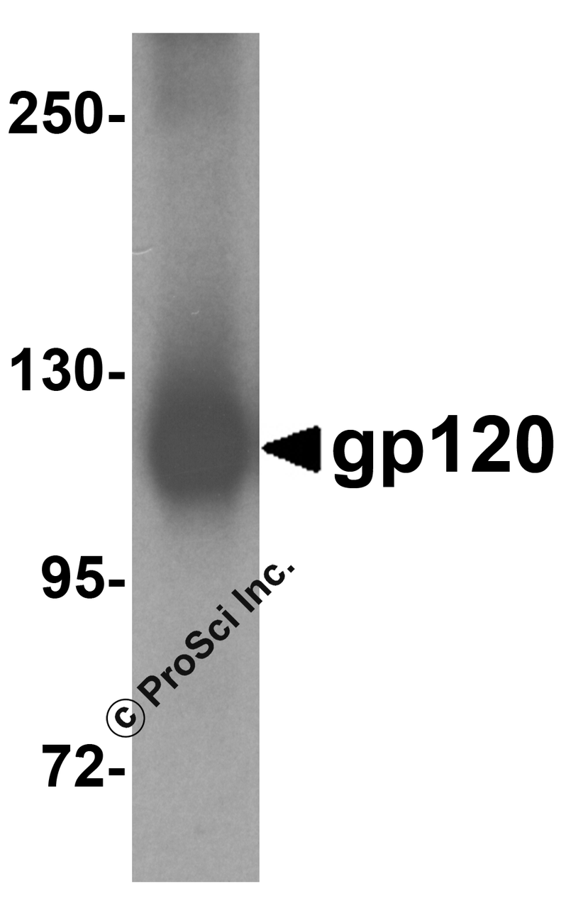 Western blot analysis of 5 ng of gp120 with gp120 antibody at 1 &#956;g/mL.