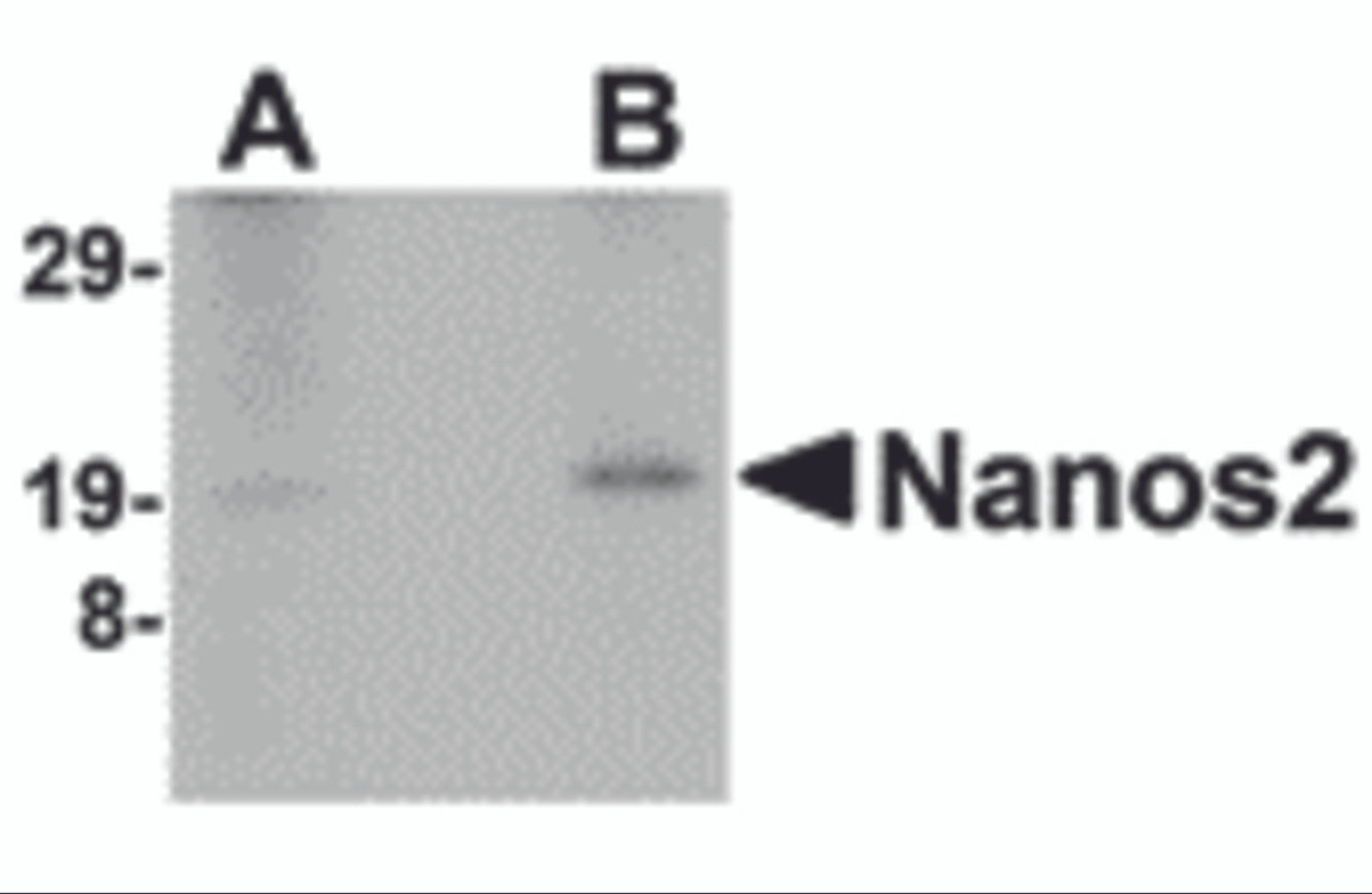 Western blot analysis of Nanos2 in human testis lyate with Nanos2 antibody at (A) 2 and (B) 4 &#956;g/mL.