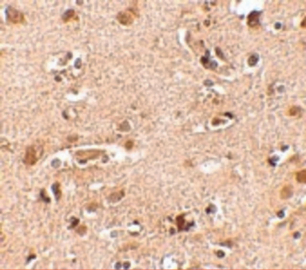 Immunohistochemistry of Nanos2 in human brain tissue cells with Nanos2 antibody at 2.5 ug/mL.