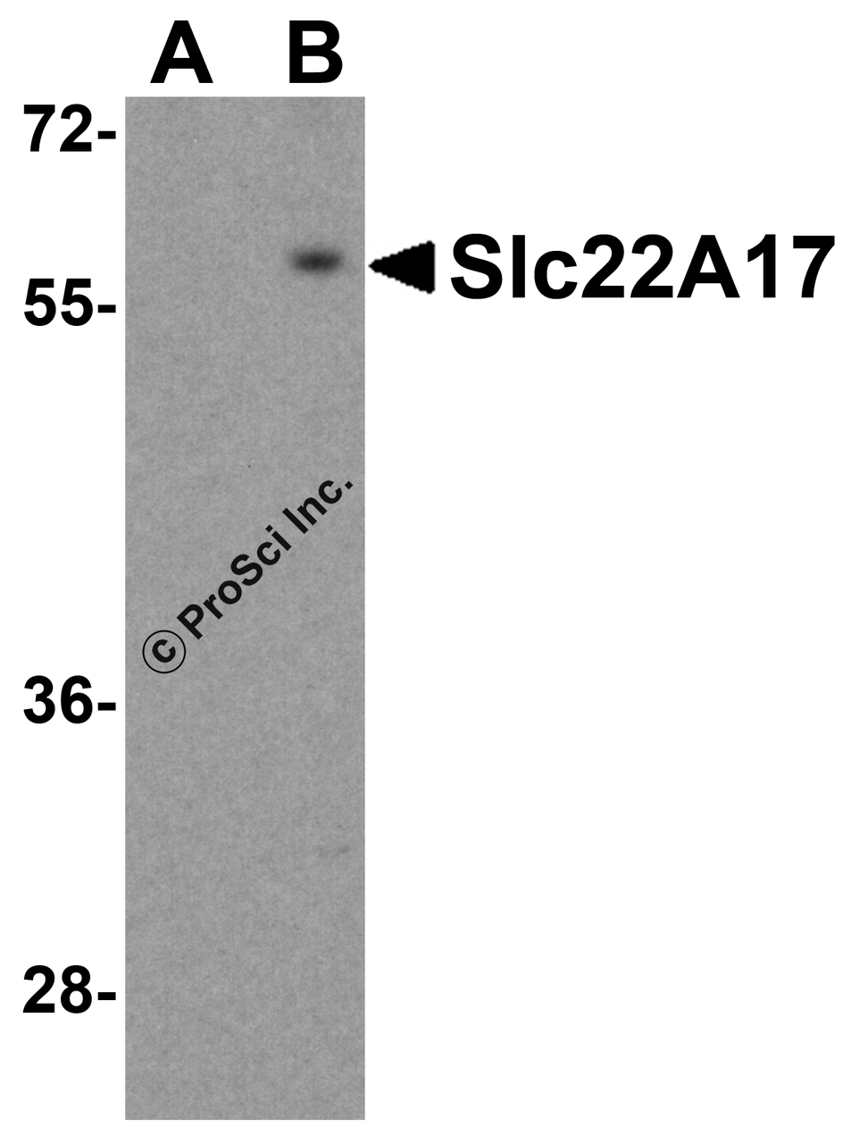 Western blot analysis of Slc22A17 in SK-N-SH lysate with Slc22A17 antibody at 0.5 &#956;g/mL in (A) the presence and (B) the absence of blocking peptide.