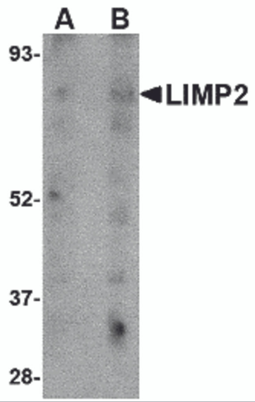 Western blot analysis of LIMP2 in human skeletal muscle tissue lysate with LIMP2 antibody at (A) 1 and (B) 2 &#956;g/mL.