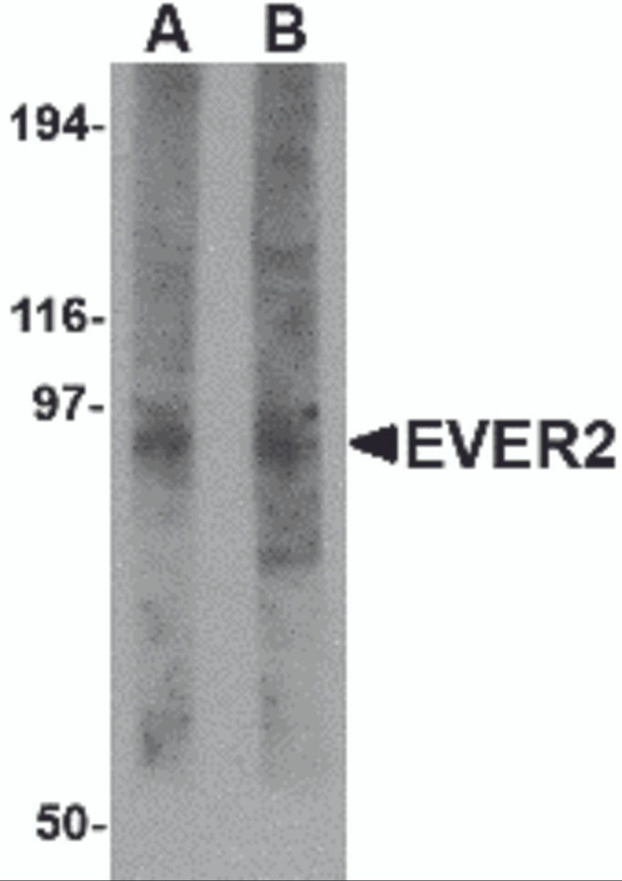 Western blot analysis of EVER2 in rat thymus tissue lysate with EVER2 antibody at (A) 1 and (B) 2 &#956;g/mL.