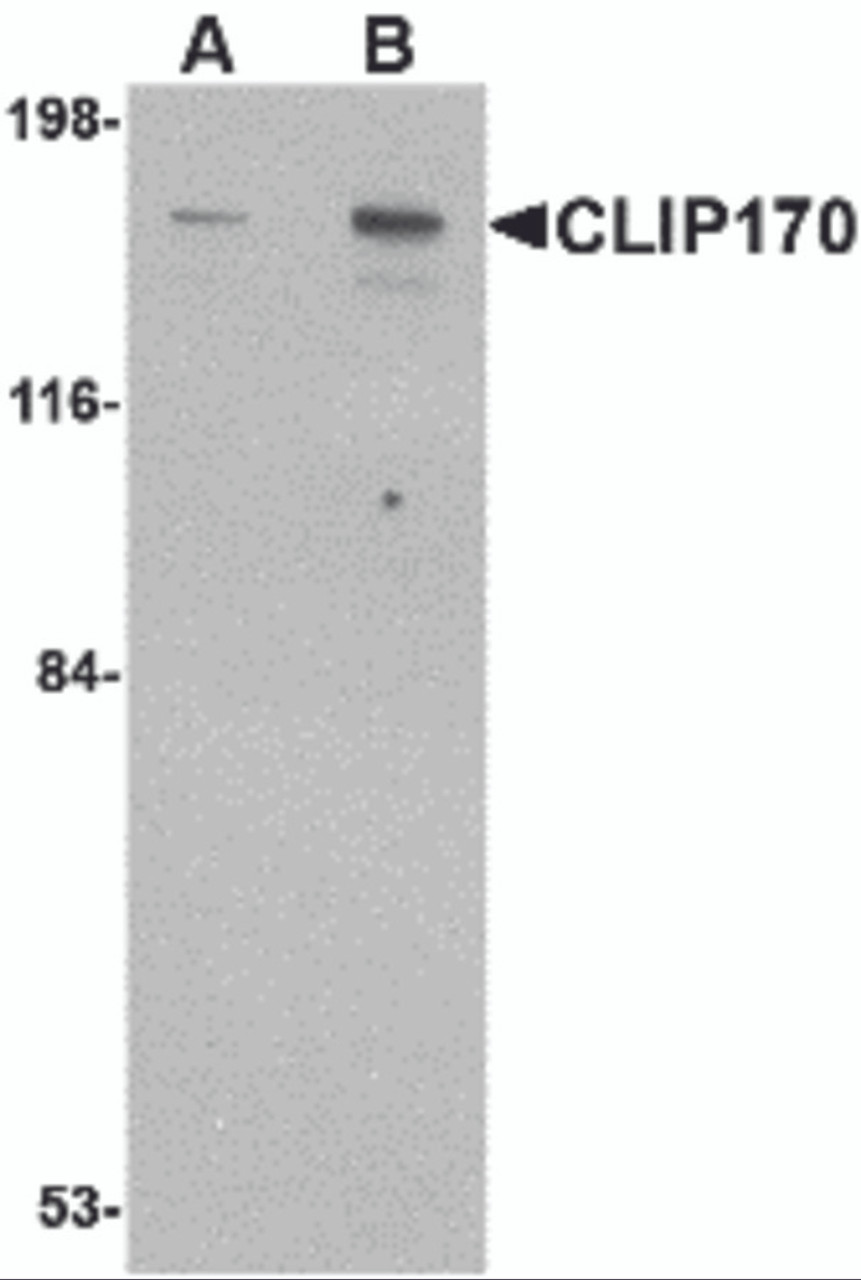 Western blot analysis of CLIP170 in rat brain tissue lysate with CLIP170 antibody at (A) 0.5 and (B) 1 &#956;g/mL.