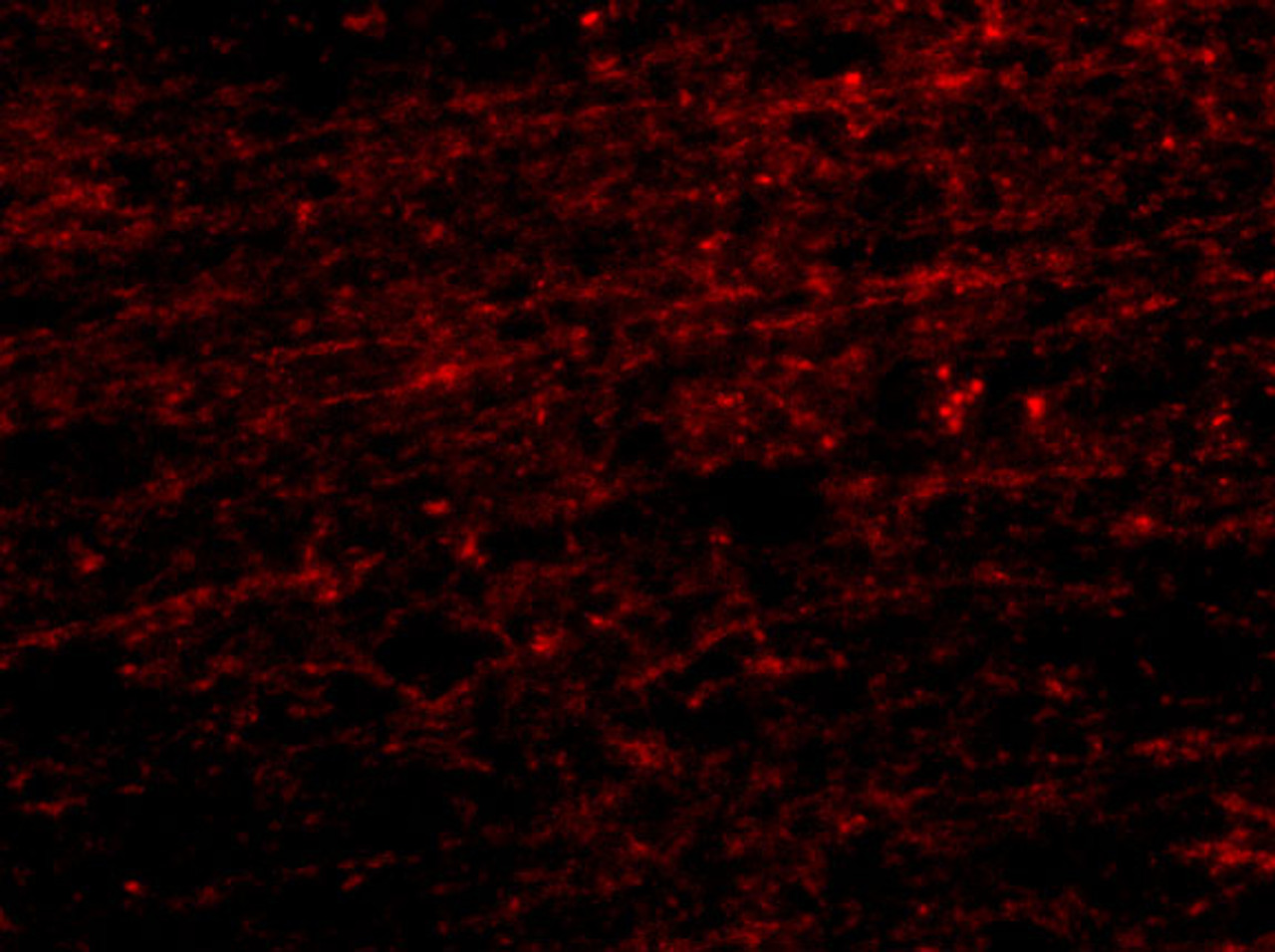 Immunofuorescence of CLIP170 in human brain tissue with CLIP170 antibody at 20 ug/mL.