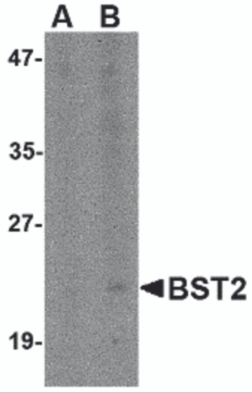 Western blot analysis of Bst2 in Daudi cell lysate with Bst2 antibody at (A) 1 and (B) 2 &#956;g/mL.
